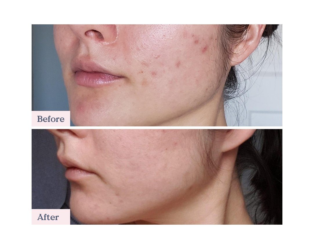 GLOW 49% JOJOBA OIL SERUM | Serum | LOSHEN & CREM