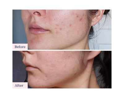 GLOW 49% JOJOBA OIL SERUM | Serum | LOSHEN & CREM
