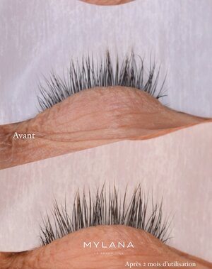 LASH SERUM MYLANA | Lash Serum | LOSHEN & CREM