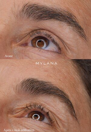 LASH SERUM MYLANA | Lash & Brow growth treatment | LOSHEN & CREM