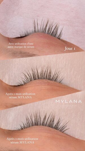 LASH SERUM MYLANA | Lash & Brow growth treatment | LOSHEN & CREM