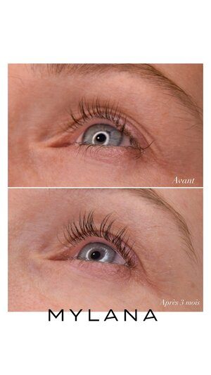 LASH SERUM MYLANA | Lash & Brow growth treatment | LOSHEN & CREM