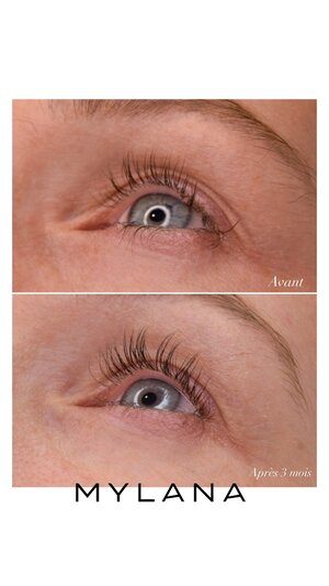 LASH SERUM MYLANA | Lash Serum | LOSHEN & CREM