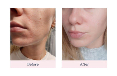 NOURISH LAVENDER + MCT CLEANSING OIL | Cleanser | LOSHEN & CREM