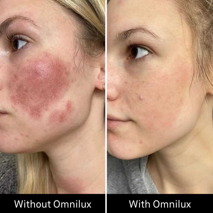 OMNILUX CONTOUR FACE | LED MASK | LOSHEN & CREM