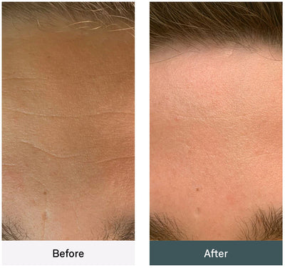OMNILUX MEN | LED MASK | LOSHEN & CREM