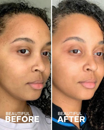 SKIN HERO BAKUCHIOL + CALENDULA BIO-RETINOL | Face Night Cream | LOSHEN & CREM