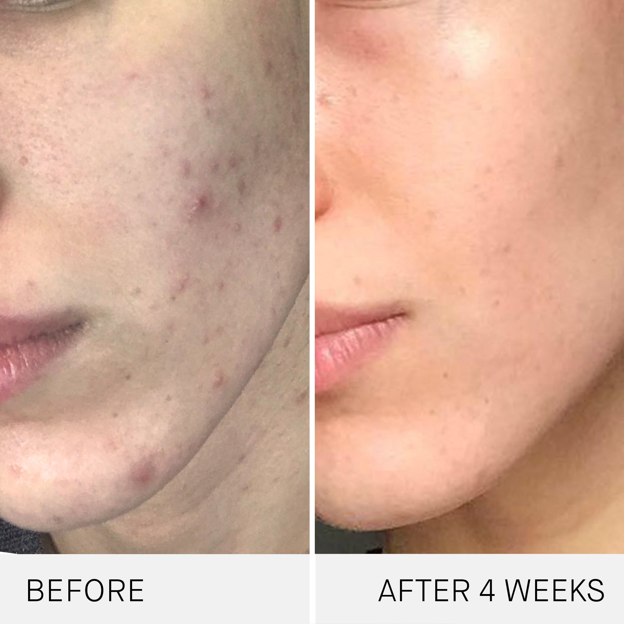 THE CREAM | Healthy aging cream | LOSHEN & CREM
